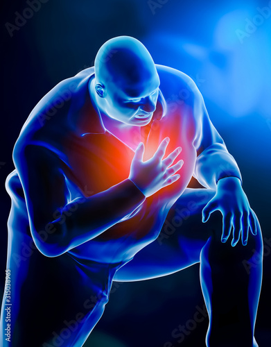 Photography Obese of fat man kneeling while suffering from a heart attack or respiratory distress or asthma or pulmonary failure 3d rendering illustration
