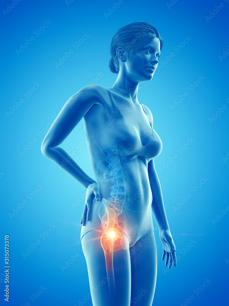 3d rendered medically accurate illustration of a woman having a painful hip 3d rendered medically accurate illustration of a woman having a painful hip