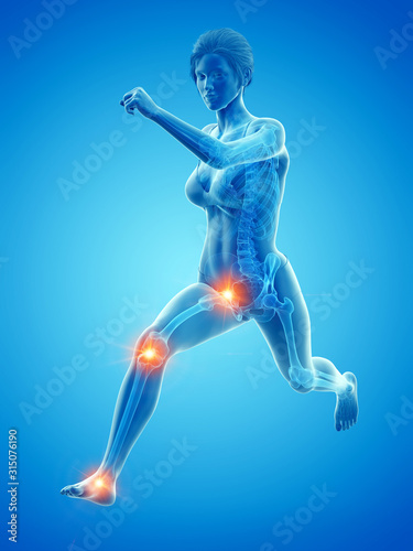 3d rendered medically accurate illustration of a woman having painful joints while running © Sebastian Kaulitzki