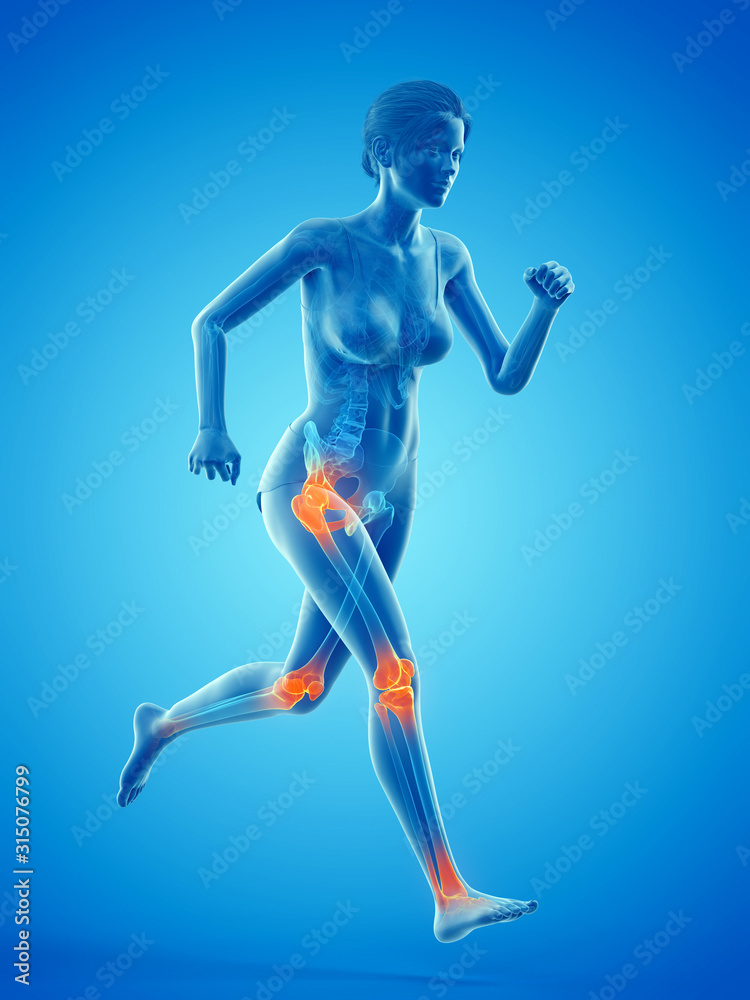 3d rendered medically accurate illustration of a woman having painful joints while running 3d rendered medically accurate illustration of a woman having painful joints while running