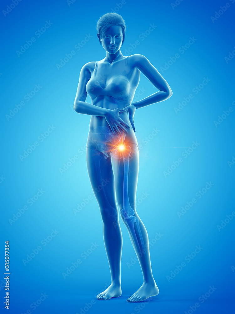 3d rendered medically accurate illustration of a woman having a painful hip 3d rendered medically accurate illustration of a woman having a painful hip