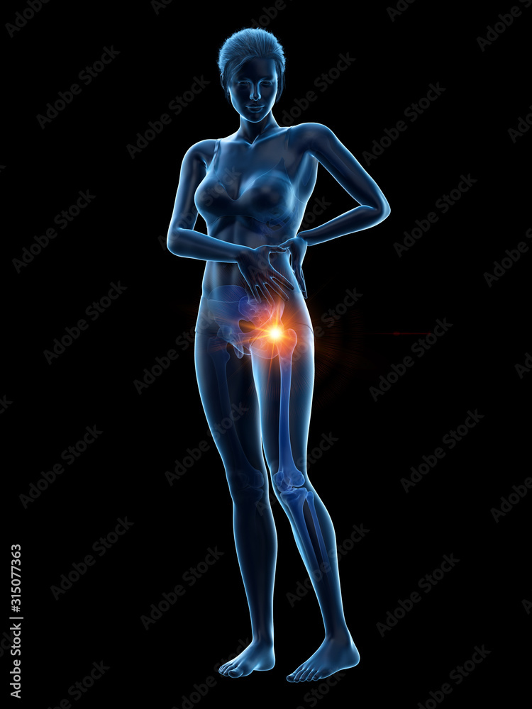 3d rendered medically accurate illustration of a woman having a painful hip