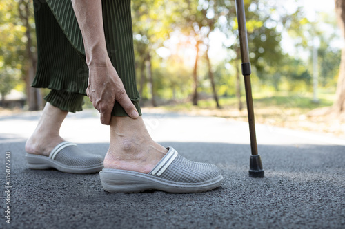 Closeup of legs of senior woman feeling pain in the joints bones,ankle tendon injury,gout disease,osteoarthritis,ligament and muscle problems,elderly people touching ankle due to sprain after walk photo