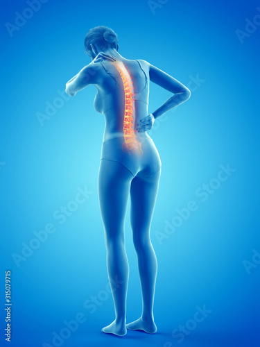 3d rendered medically accurate illustration of a woman having a painful back © Sebastian Kaulitzki