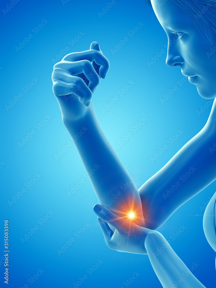 3d rendered medically accurate illustration of a woman having a painful elbow 3d rendered medically accurate illustration of a woman having a painful elbow