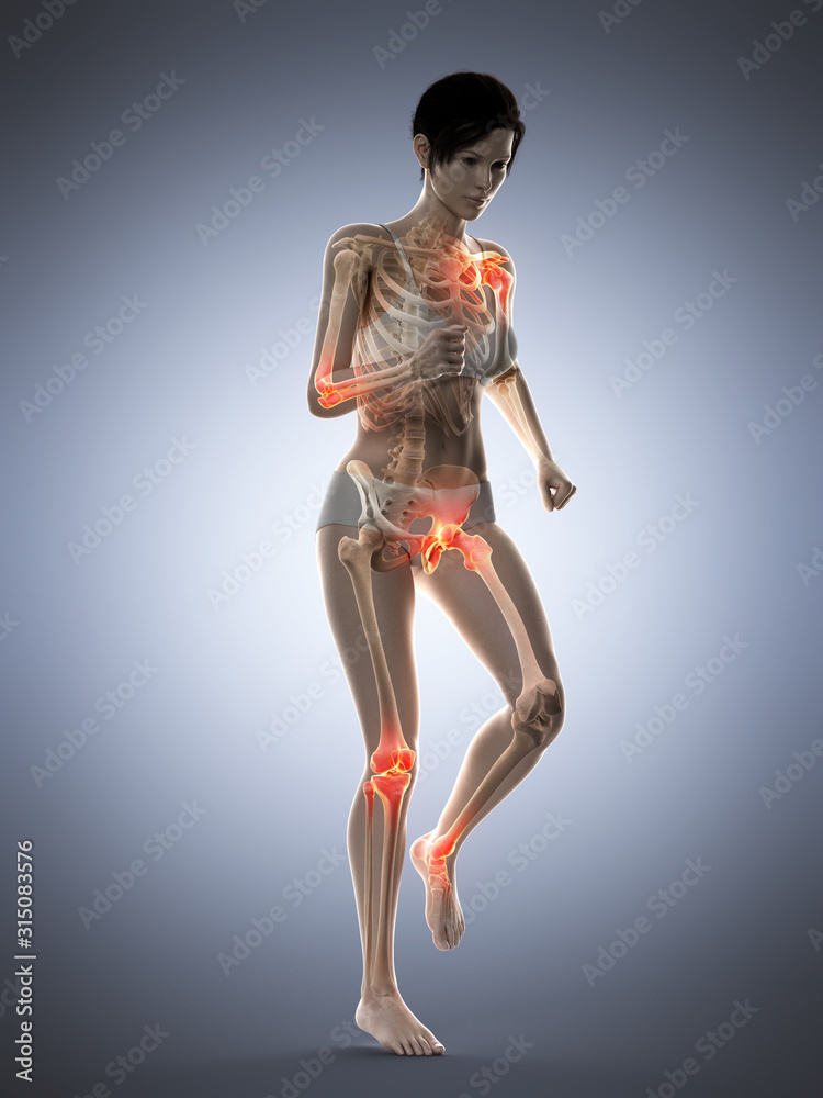 3d rendered medically accurate illustration of a woman having painful joints while walking 3d rendered medically accurate illustration of a woman having painful joints while walking