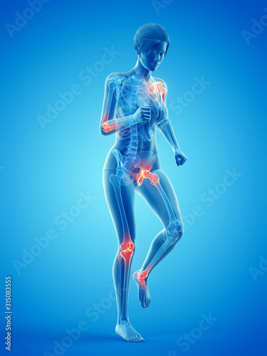 Принти на полотні 3d rendered medically accurate illustration of a woman having painful joints whi
