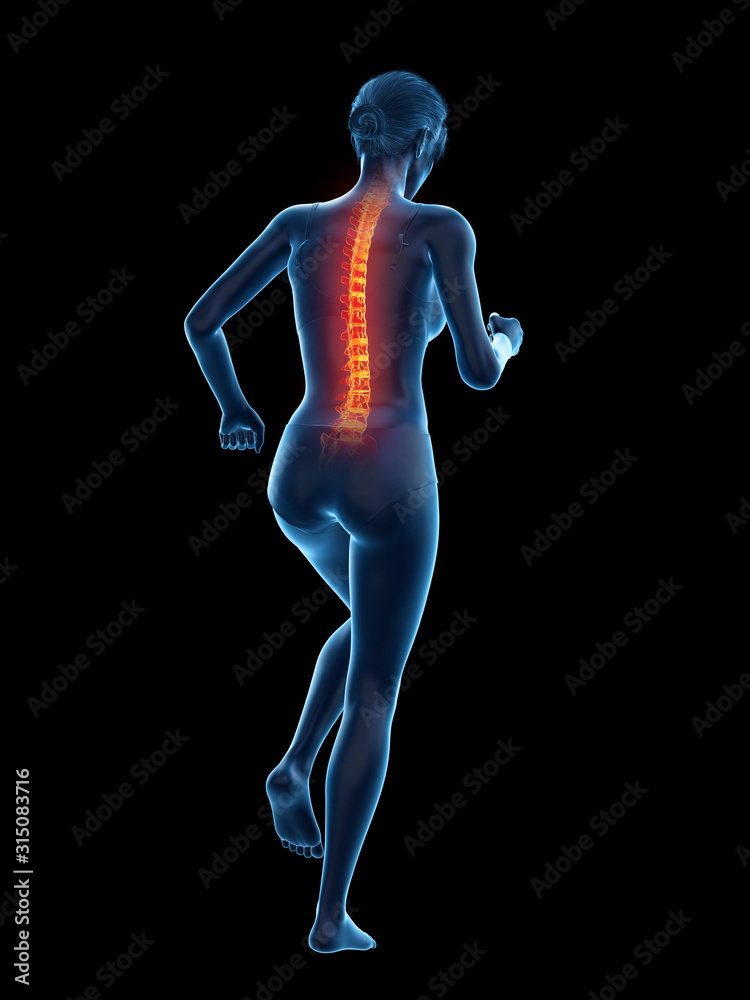 3d rendered medically accurate illustration of a woman having a painful back while walking