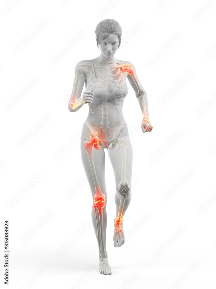 3d rendered medically accurate illustration of a woman having painful joints while walking 3d rendered medically accurate illustration of a woman having painful joints while walking