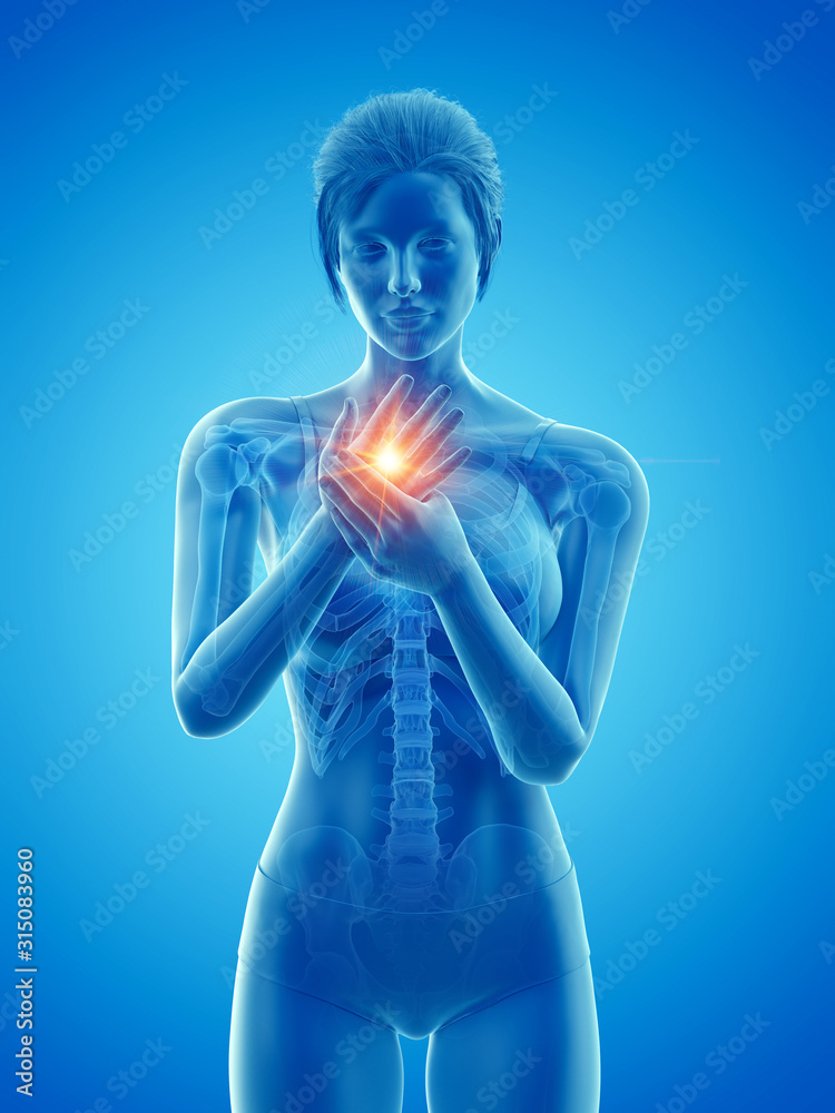3d rendered medically accurate illustration of a woman having a painful hand 3d rendered medically accurate illustration of a woman having a painful hand