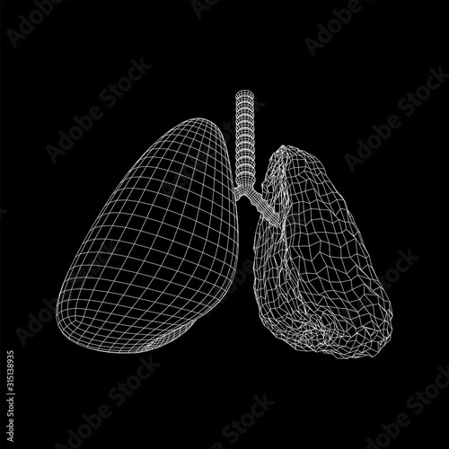 Healthy and sick lung with trachea bronchi internal organ human. Pulmonology medicine science technology concept. Wireframe low poly mesh vector illustration