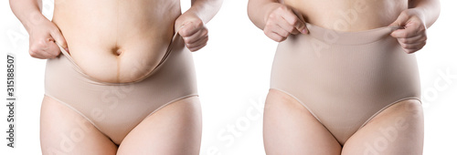 Woman's body before and after weight loss, flabby belly after pregnancy, fat woman in corrective panties isolated on white background