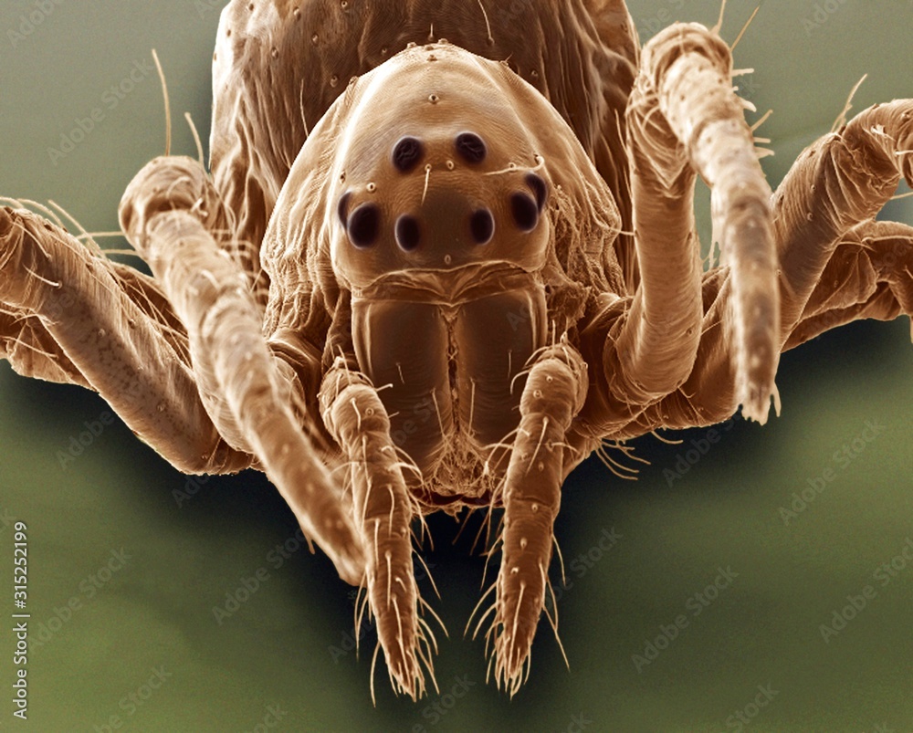 Baby spider, SEM Stock Photo Adobe Stock