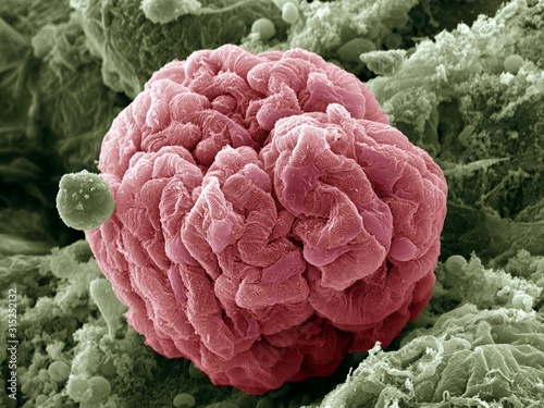 Kidney glomerulus, SEM