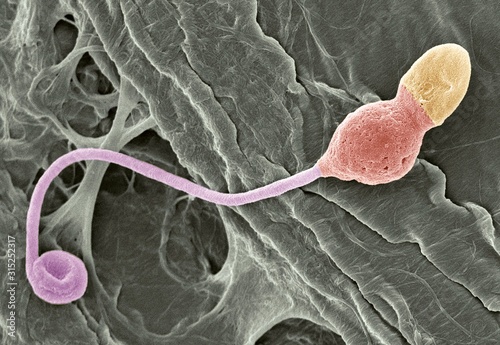 Deformed sperm cell, SEM