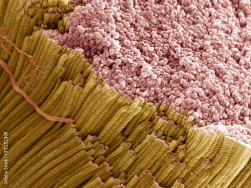 Tendon, SEM