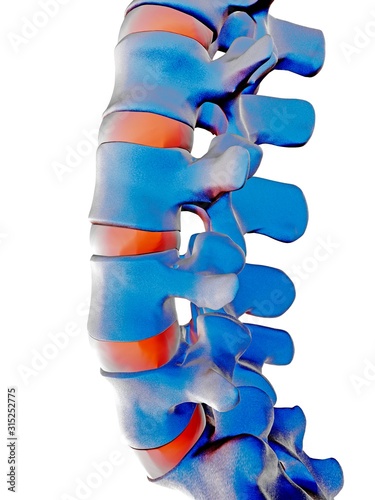 Lumbar spine, computer artwork photo