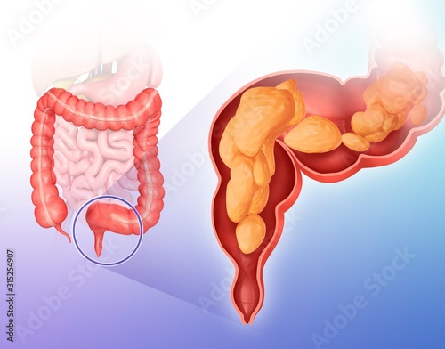 Cross section of intestine, illustration photo
