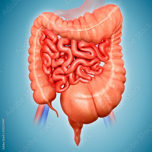 Megacolon, illustration photo