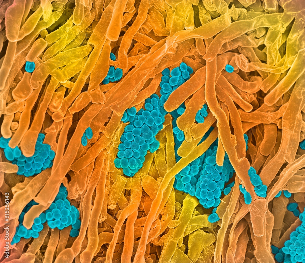 Streptomyces coelicoflavus bacteria, SEM Stock Photo Adobe Stock