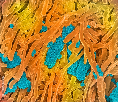 Streptomyces coelicoflavus bacteria, SEM photo