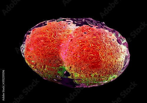 Smallpox virus, illustration photo