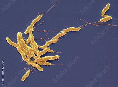 Campylobacter jejuni bacteria, SEM photo