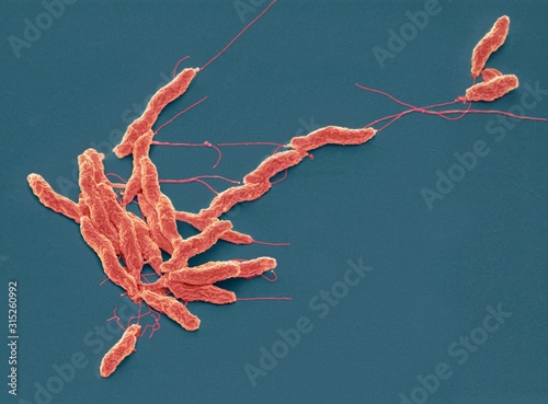 Campylobacter jejuni bacteria, SEM photo