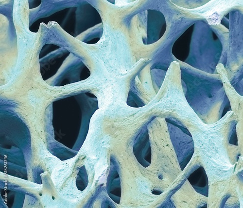 Bone tissue, SEM photo