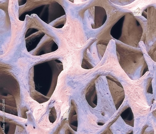 Bone tissue, SEM