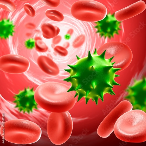 Norovirus infection, illustration photo