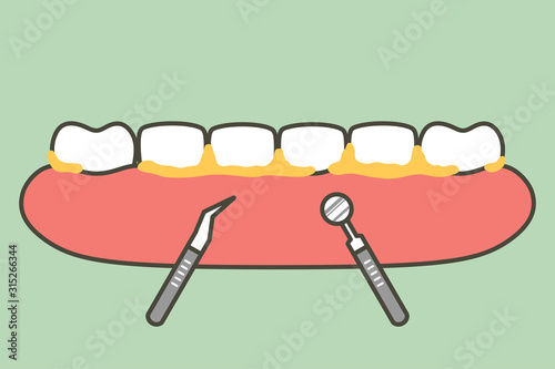 teeth scaling, dental plaque removal for cleaning - tooth cartoon vector flat style