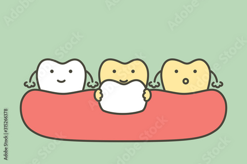 dental veneers installation procedure for tooth whiten - teeth cartoon vector flat style