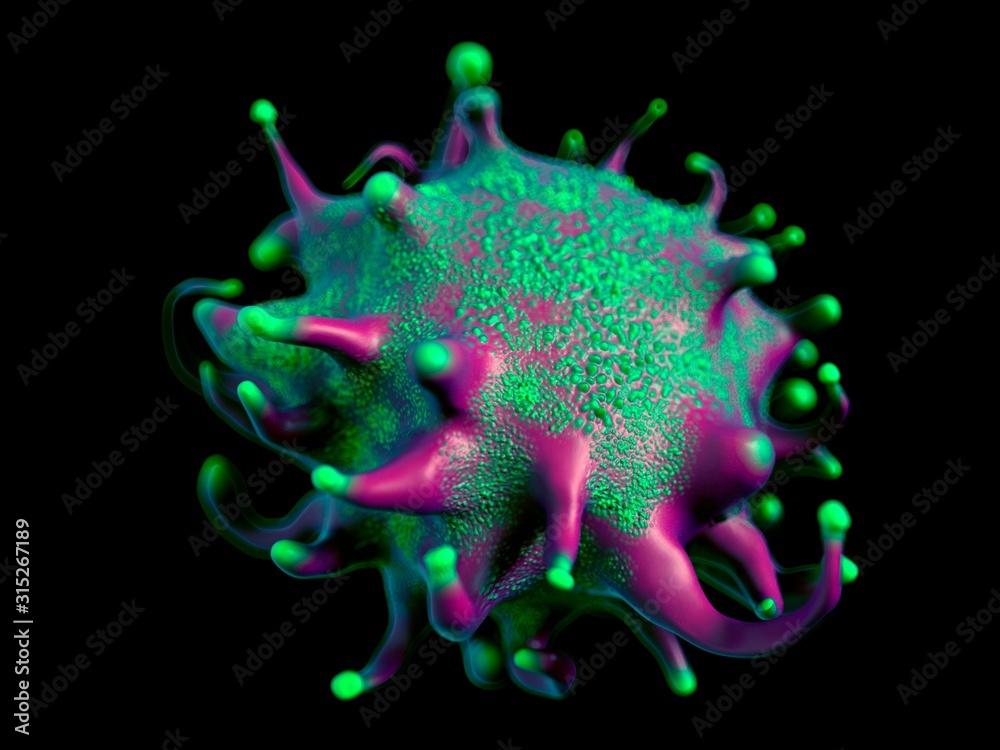 Lymphoma cancer cell