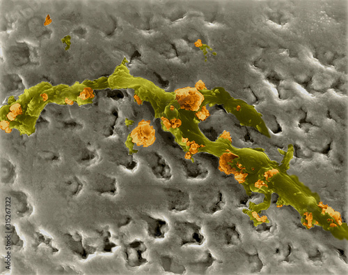 Human tooth with plaque, SEM
