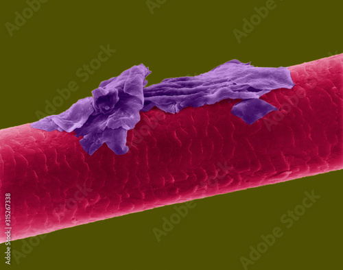 Human hair with dandruff, SEM