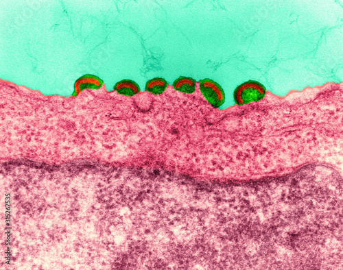HIV infection in lymph tissue, TEM photo