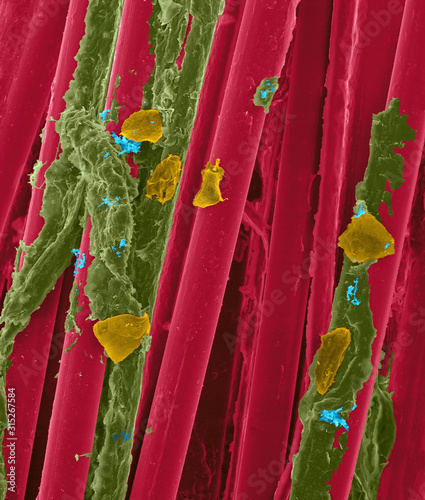 Used wax dental floss, SEM