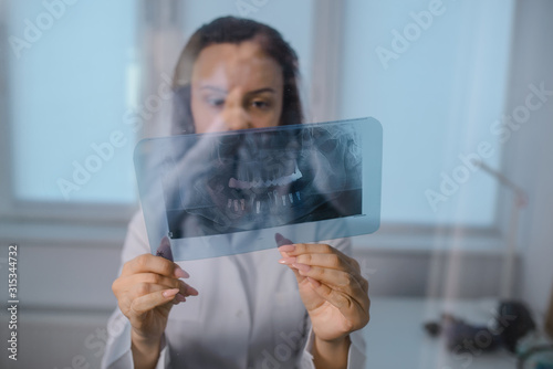 Close up picture of young woman doctor dentist who analysis dental x ray orthopantomogram. Dental panoramic radiography photo