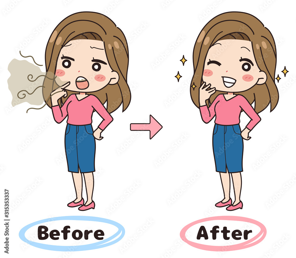 口臭に悩んだ女性のイラスト ビフォーアフター 全身図 Stock Vector Adobe Stock