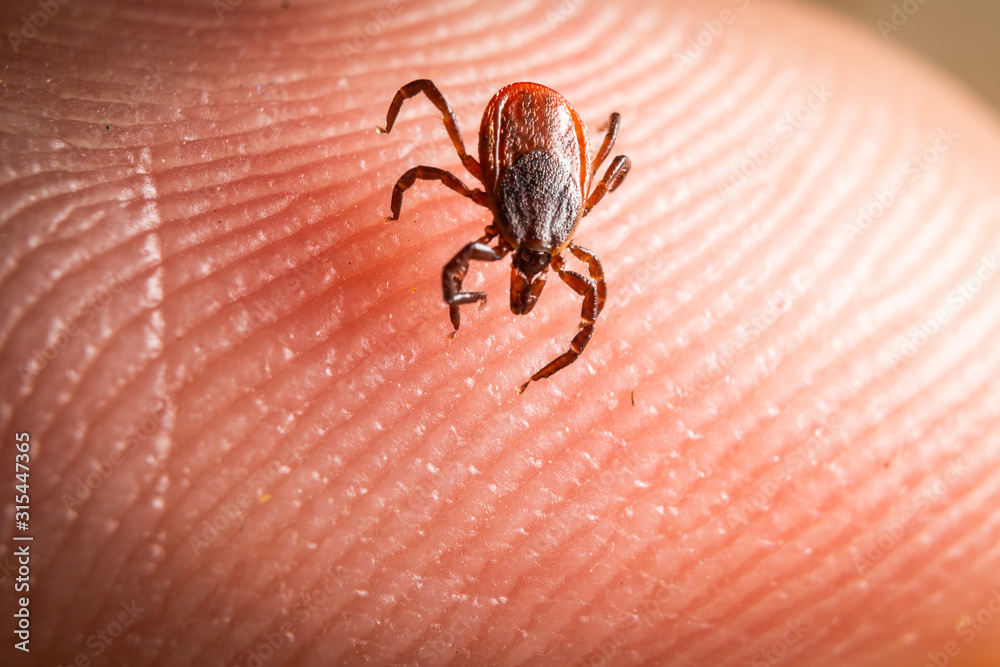 Deer Tick Deer Tick