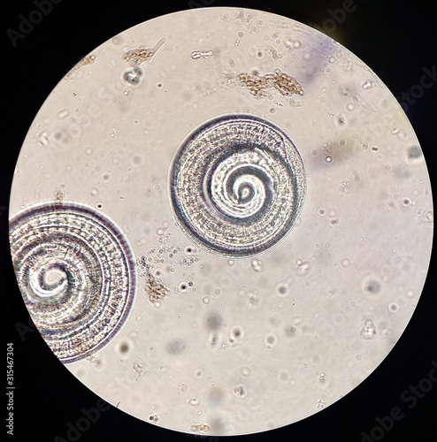 Trichinella spiralis imagen microscopio
