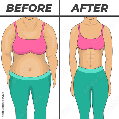 Weigh loss concept design. Overweight problem concept. Isolated vector illustration