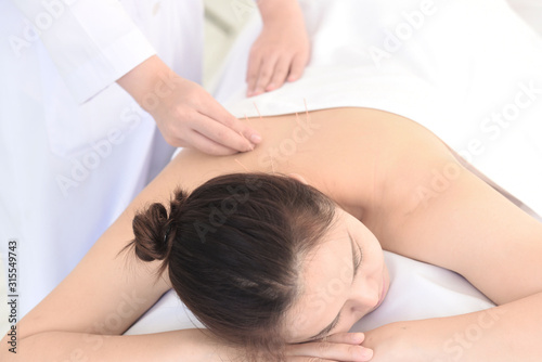 acupuncture treatment therapy by doctor