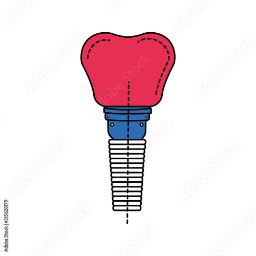 Dental implant tooth color line icon. Metal post that replaces the root portion of a missing tooth. Pictogram for web page, mobile app, promo. UI UX GUI design element. Editable stroke.