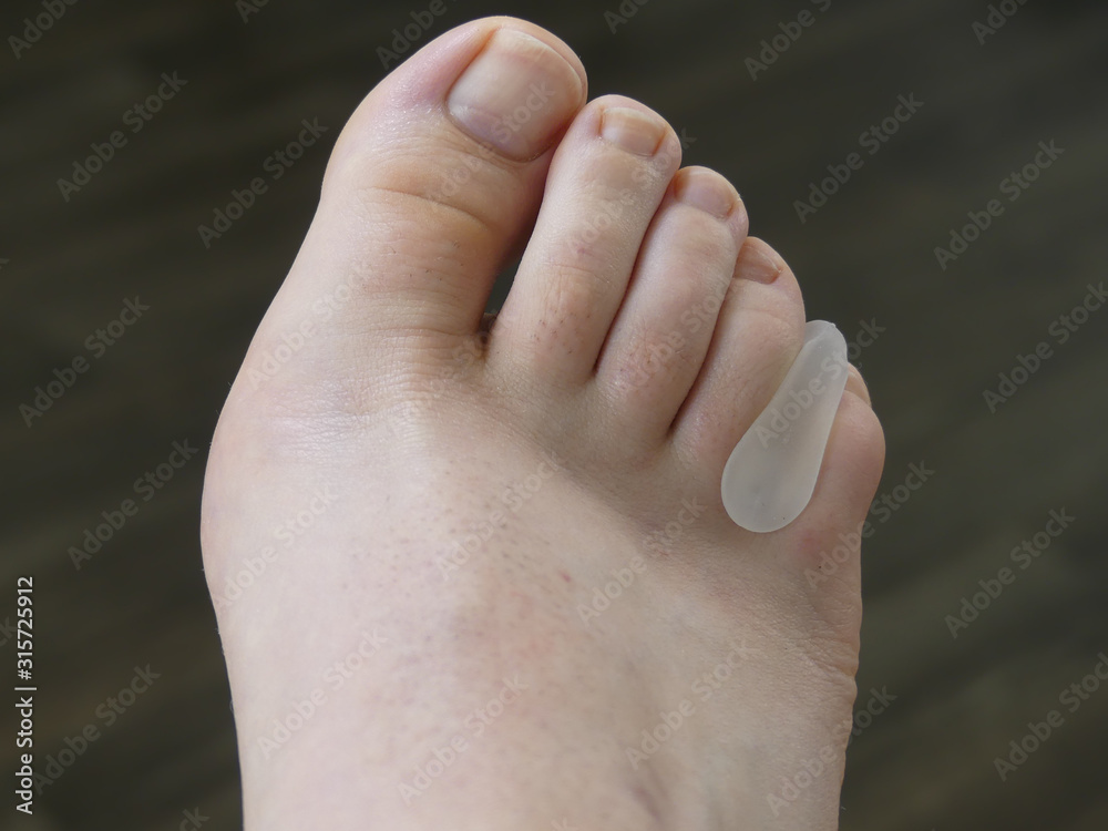 Chiropody Podiatry Medical Foot Care Chiropody Podiatry Medical Foot Care