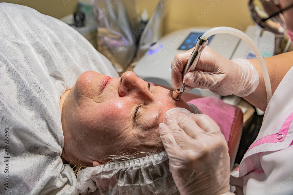 The cosmetic procedure for laser facial skin cleansing is performed for an aged woman. Instrumental effect on the surface of the skin. Improving skin turgor, rejuvenation and healing. The cosmetic procedure for laser facial skin cleansing is performed for an aged woman. Instrumental effect on the surface of the skin. Improving skin turgor, rejuvenation and healing.