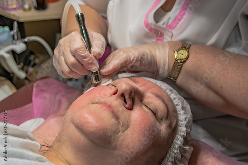The cosmetic procedure for laser facial skin cleansing is performed for an aged woman. Instrumental effect on the surface of the skin. Improving skin turgor  rejuvenation and healing.