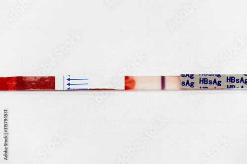 Hepatitis B Surface Antigen (HBsAg) Test Strip is a rapid, qualitative test for the detection of hepatitis B surface antigen in whole blood. photo