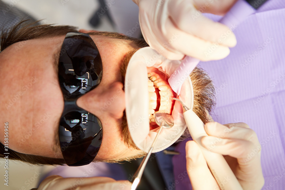 Dentist removes tartar or tooth decay Stock Photo Adobe Stock